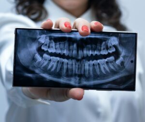Photo by Laura Villela Beauty Designer | Brasil : https://www.pexels.com/photo/dental-x-ray-displayed-on-smartphone-in-hand-32852538/ - whole mouth xray with wisdom teeth